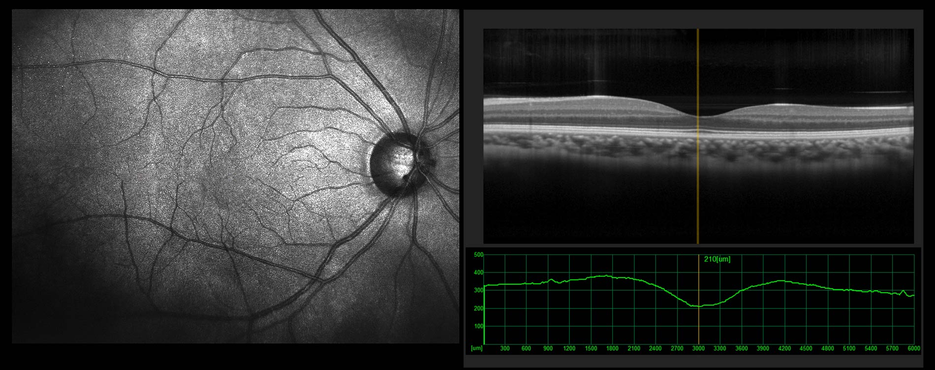 Happy patients with improved vision provided by Long Beach Retina | Roberto Roizenblatt, MD, PhD, FASRS